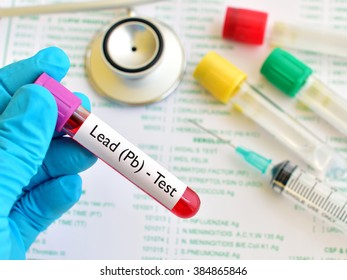 Test Tube With Blood Sample For Lead (Pb) Metal Test