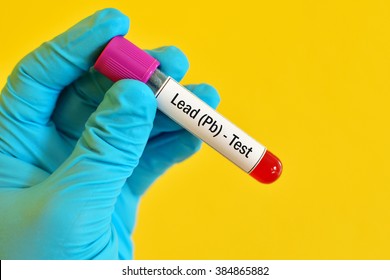 Test Tube With Blood Sample For Lead (Pb) Metal Test