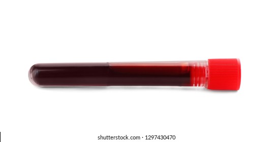 Test Tube With Blood Sample On White Background