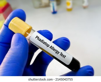 Test Tube Blood Sample Phadiatop Allergy Stock Photo 2145043755 ...