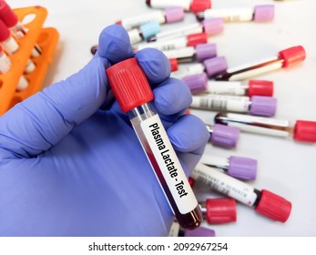 Test Tube Blood Sample Plasma Lactate Stock Photo (Edit Now) 2092967254