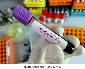 15 Quantiferon test tb Images, Stock Photos & Vectors | Shutterstock