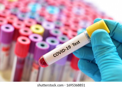Test tube with blood sample for SARS-CoV-2 or COVID-19 virus test