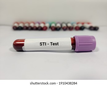 Test Tube With Blood Sample For STI (sexually Transmitted Infection) Test.