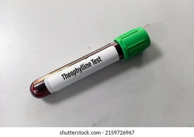 Test Tube Blood Sample Theophylline Test Stock Photo 2159726967 ...