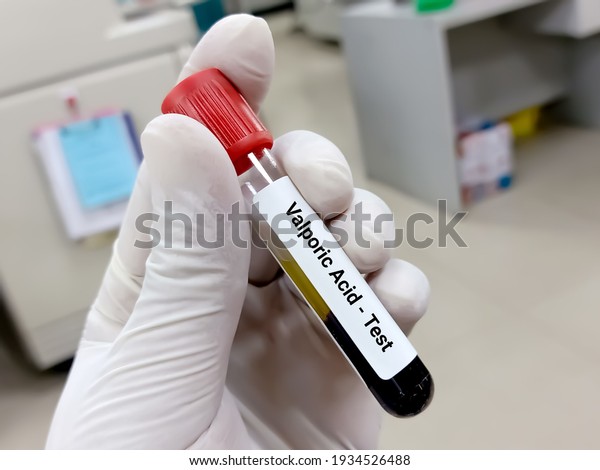 Test Tube Blood Sample Valporic Acid Stock Photo 1934526488 | Shutterstock