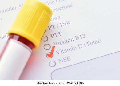 Test Tube Blood Sample Vitamin D Stock Photo 1059091796 