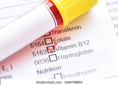 Test Tube With Blood Sample For Vitamin B12 Test
