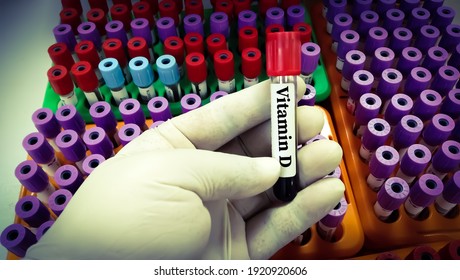 Test Tube With Blood Sample For Vitamin D Test