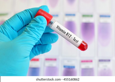Test Tube With Blood Sample For Vitamin B12 Test
