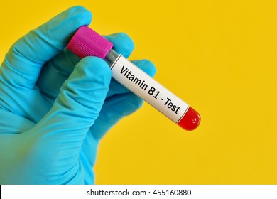 Test Tube With Blood Sample For Vitamin B1 Test
