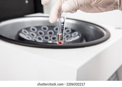 Test Tube With Bone Marrow Cells Pellet Obtained After Centrifugation. Scientist Preparing Bone Marrow Samples For Flow Cytometric Analysis In The Laboratory.