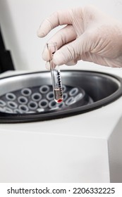 Test Tube With Bone Marrow Cells Pellet Obtained After Centrifugation. Scientist Preparing Bone Marrow Samples For Flow Cytometric Analysis In The Laboratory.