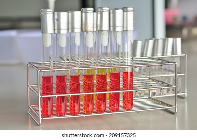 Test Tube Microbiology Laboratory Test Stock Photo 209157325 | Shutterstock