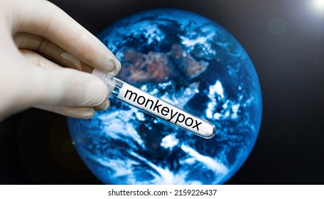 test tube with the monkeypox virus in the hand of a scientist on the background of the planet, the virus is spreading in a pandemic