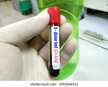 Test Tube With Positive Blood Sample For D-dimer Test, Diagnosis For Disseminated Intravascular Coagulation