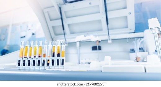 Test Tubes With Blood For Automatic Biochemical Analyzer. Medical Lab Equipment Biomedical Banner.