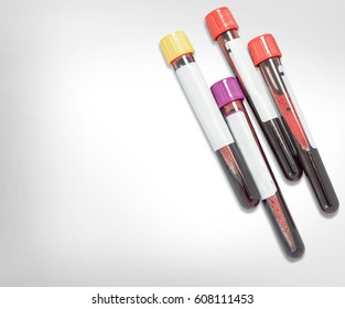 Test Tubes With Blood Samples Isolated On White Background