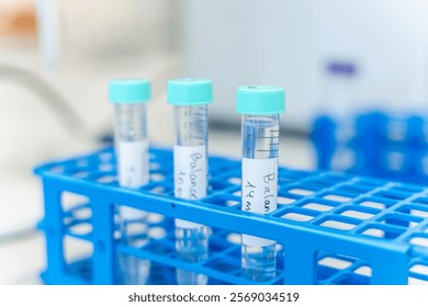 Test tubes containing transparent samples are carefully placed in a blue rack inside a laboratory, suggesting ongoing scientific research or analysis