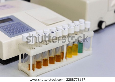 Test tubes with multi-colored reagent analysis. Colorimetry expe