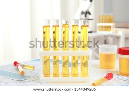 Test tubes with urine samples for analysis on white table in laboratory