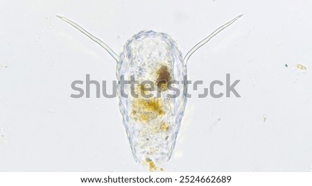 Testate amoeba, Euglypha sp. Collected from the pond. Fresh sample without staining. Selective focus image
