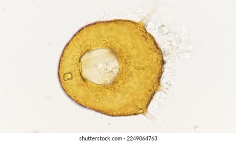 Testate amoeba, an amoeba with a smooth shell. Genus Centropyxis. Lugol fixed sample. 400x objective. selective focus