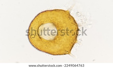 Testate amoeba, an amoeba with a smooth shell. Genus Centropyxis. Lugol fixed sample. 400x objective. selective focus