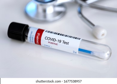 Testing for presence of coronavirus. Tube containing a swab sample for COVID-19 that has tested positive. - Shutterstock ID 1677538957