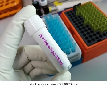 Testing Tube With Vaginal Fluid Sample For HPV DNA Test, Human Papilloma Virus, Cervical Cancer. A Medical Testing Concept In The Laboratory