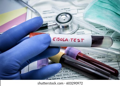 Tests For Research Of Ebola virus