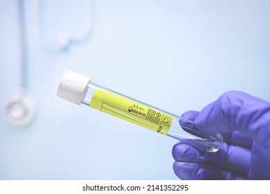 Test-tube for taking urine in a doctor's hand in medical glove on blue medical background. Medical tests, empty test-tube, biomaterial container. Laboratory glassware. Urine test. Urine analysis.