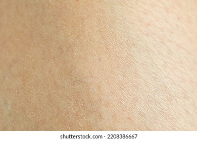 Texture Of Clean Human Skin, Closeup View