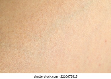 Texture Of Clean Human Skin, Closeup View