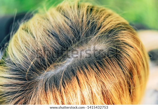 Texture Hair On Girls Head Black Stock Photo Edit Now 1415432753