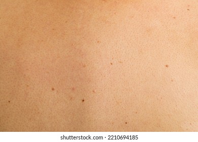 Texture of human skin with birthmarks, closeup view - Shutterstock ID 2210694185
