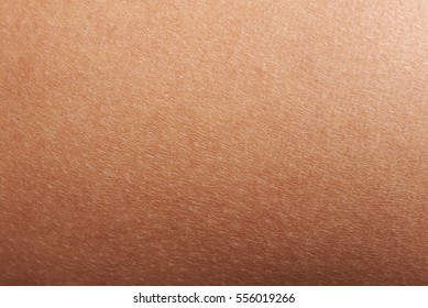 Texture Of Human Skin Closeup With Small Defects