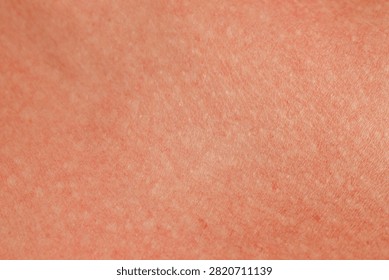 Texture of normal skin as background, closeup