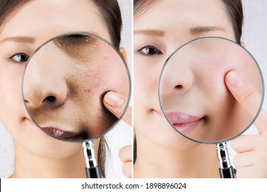 The texture of the skin of young women is magnified and compared with a magnifying glass.