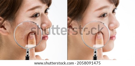 The texture of the skin of young women is magnified and compared with a magnifying glass.