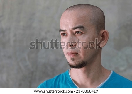 Thai bald man grow a beard 
acne blemishes on loft wall background