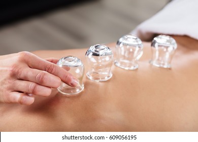 Therapist Placing Transparent Glass Cups On Person's Back In Spa - Shutterstock ID 609056195