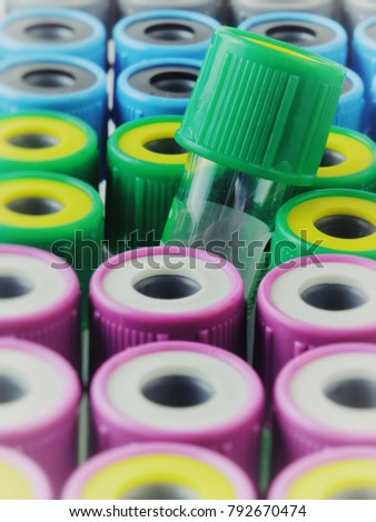 There are many Test Tubes with multicolor lids on the Test Tube rack. Macro photo with Test Tube for blood.
