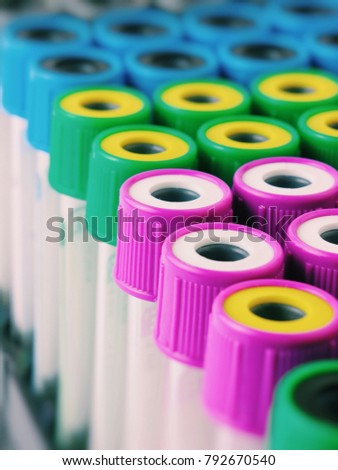 There are many Test Tubes with multicolor lids on the Test Tube rack. Macro photo with Test Tube for blood.