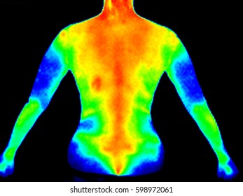 Thermographic image of the back of a woman showing complete spine with photo showing different temperatures in range of colors, blue showing cold, red showing hot which can indicate joint inflammation