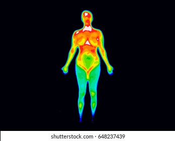 Thermographic image of the front of the whole body of a woman with photo showing different temperatures in range of colors from blue showing cold to red showing hot, can indicate joint inflammation. 