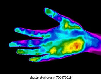 Thermographic image of Hand with different temperatures in range