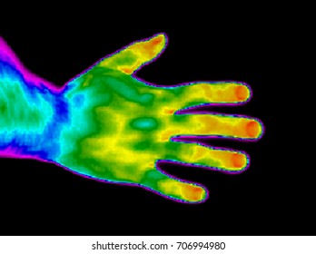 Thermographic image of Hand with different temperatures in range of colors, Purple showing cold, red showing hot.