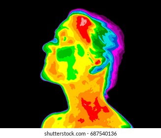 Thermographic image of human face and neck showing different temperatures, from blue cold to red hot.Red in neck possible cartoid inflammation, Cerebrovascular Accident (CVA) (medical term for stroke)