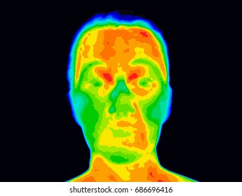 Thermographic photo of a human face showing different temperatures in a range of colors from blue cold to red hot. Red and orange around mouth could be a sign of periodontal disease with inflammation.
